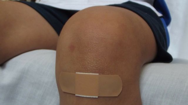 How To Treat The 10 Most Common Household Injuries