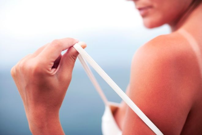A Complete Guide For Detection And Treatment Of Sun Poisoning